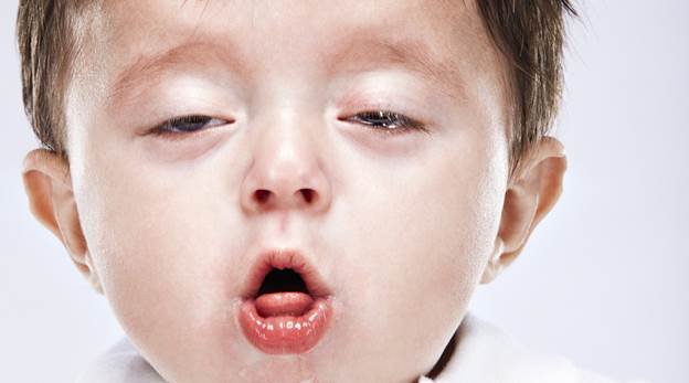 Bệnh ho gà: Nguyên nhân, triệu chứng, biến chứng và cách điều trị